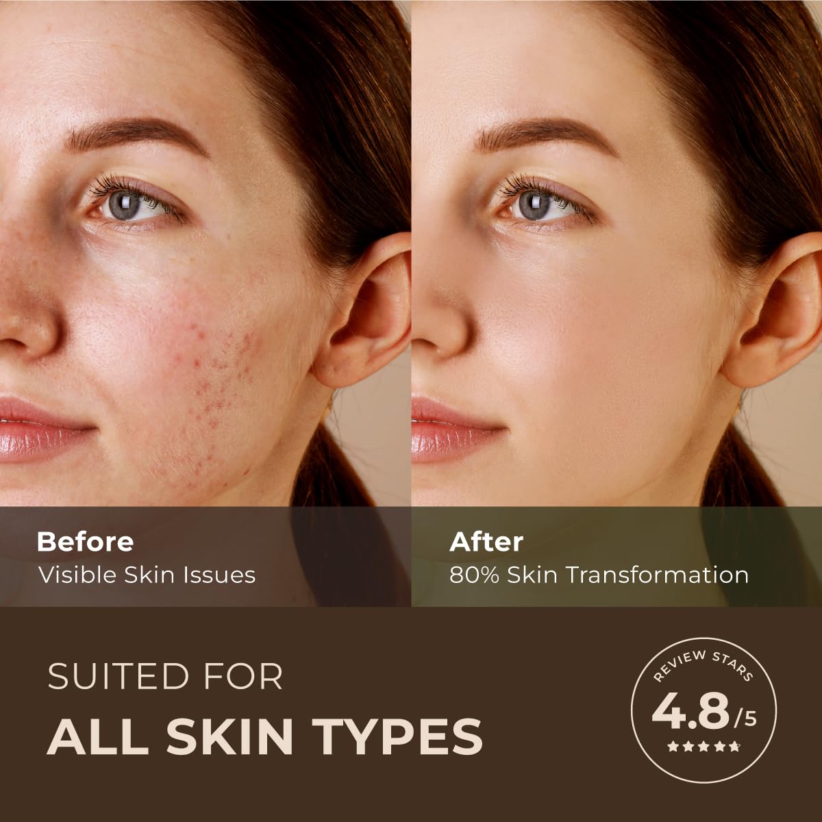 Gya Labs Australian Tea Tree Essential Oil for Skin - 0.34 Fl Oz - 100% Pure Natural Melaleuca Tea Tree Oil for Hair, Face, & Toenail, Piercings Scalp & Candle Making Scent