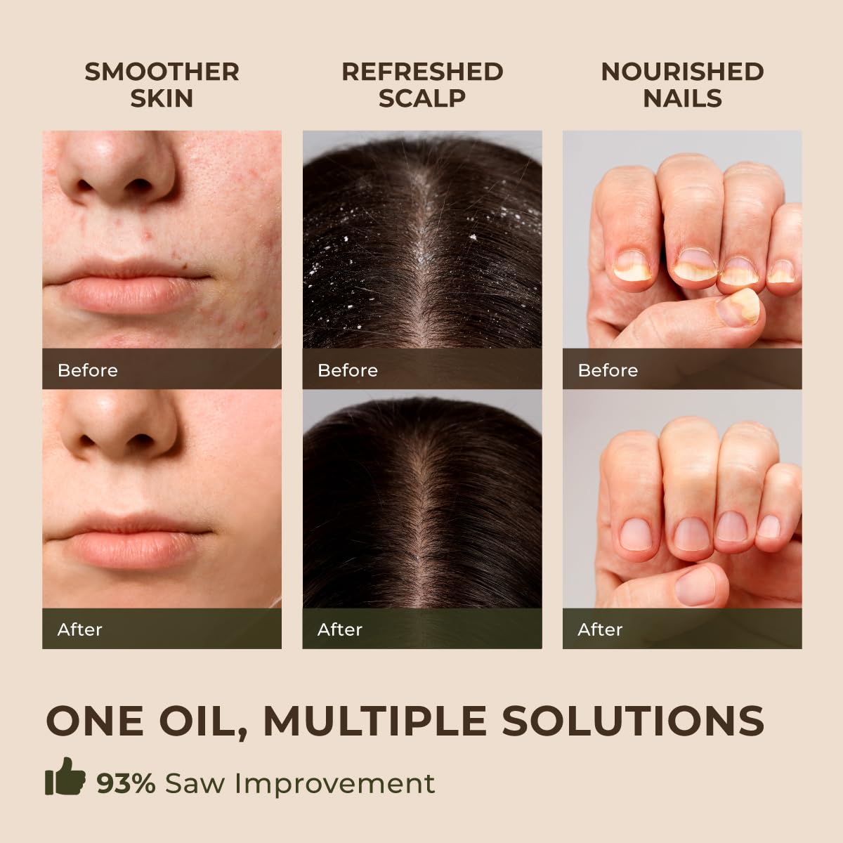 Gya Labs Australian Tea Tree Essential Oil for Skin - 0.34 Fl Oz - 100% Pure Natural Melaleuca Tea Tree Oil for Hair, Face, & Toenail, Piercings Scalp & Candle Making Scent