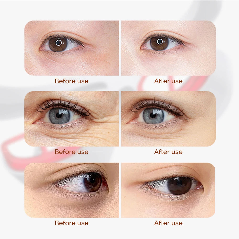 Electric Eye Massager Red Light Relieves Eye Fatigue Eyes Massage Glasses Eye Glasses Massager Dark Circles Remover
