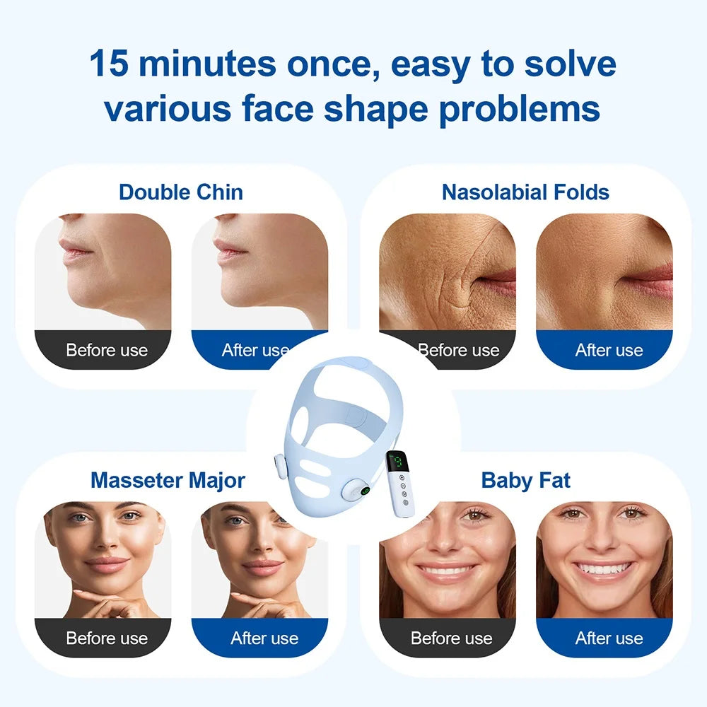Face Slimming Bandage V Line Face Lifting Mask Double Chin Reducer Cheek Lift Up Shaper Cheek Slimmer Remove Edema Massager