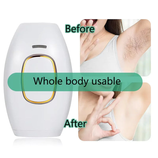 Popular hair removal device laser, IPL womens shaving strong pulse hair removal