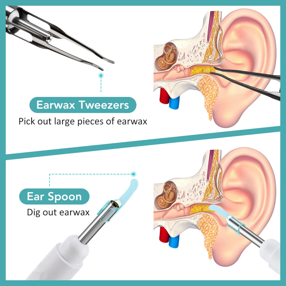 Smart Visual Ear Camera Set HD1080P 3.5MM WIFI Ear Pick Ear Cleaner Endoscope With Tweezers Ear Wax Removal Tool Ear Spoon Case
