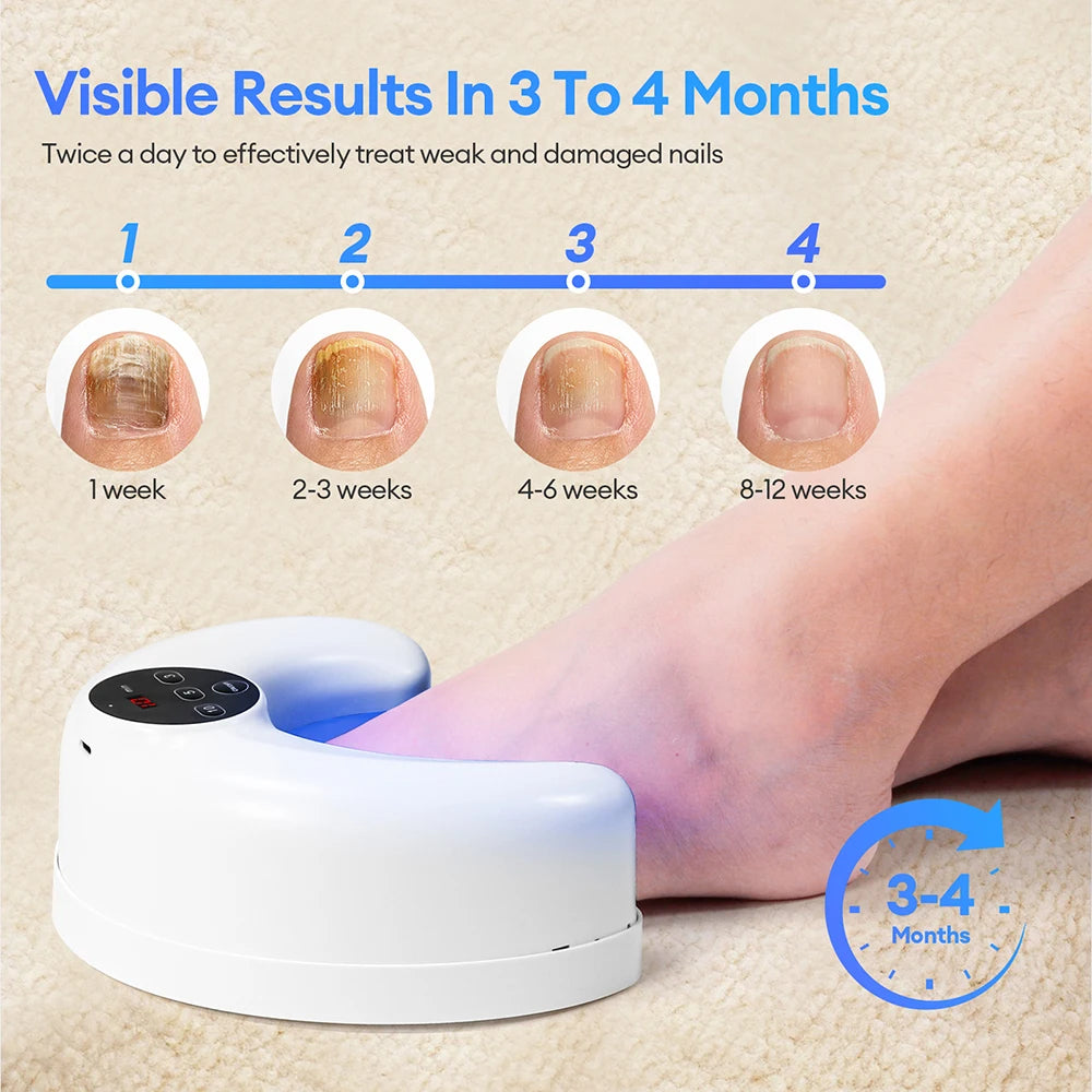 Hand Foot Nail Nail Fungus Laser Device Toenail Fungus Treatment Lamp Infrared Blue Light Anti Fungal Laser Nail Lamp