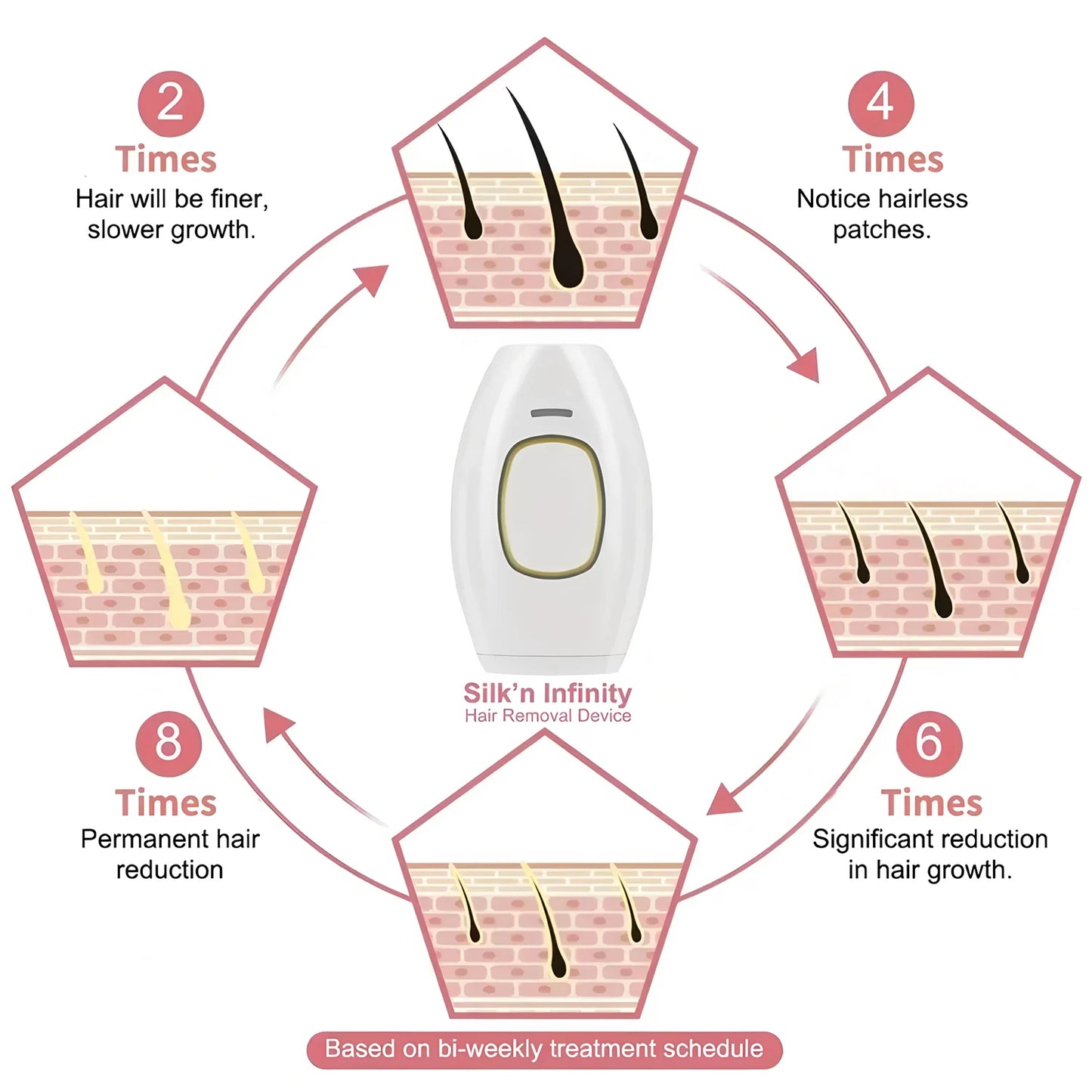 Laser Hair Removal Unlimited Flash Ice-cooling IPL Device, Long-Lasting Results