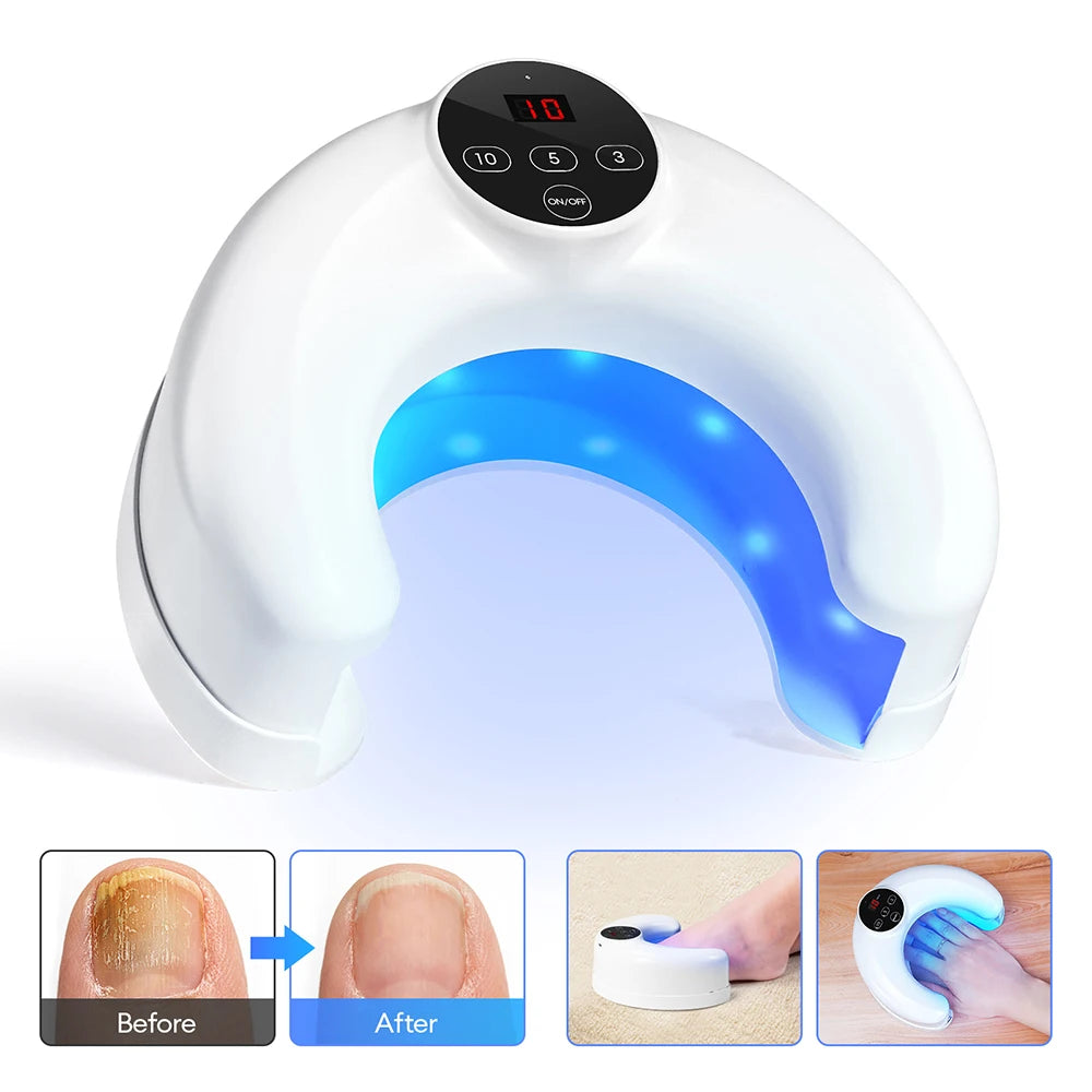 Hand Foot Nail Nail Fungus Laser Device Toenail Fungus Treatment Lamp Infrared Blue Light Anti Fungal Laser Nail Lamp