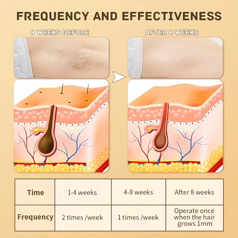 Swoson Pro Permanent Laser Depilator Body Bikini IPL Hair Removal Handset Tools