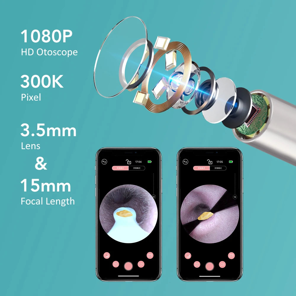 Smart Visual Ear Camera Set HD1080P 3.5MM WIFI Ear Pick Ear Cleaner Endoscope With Tweezers Ear Wax Removal Tool Ear Spoon Case