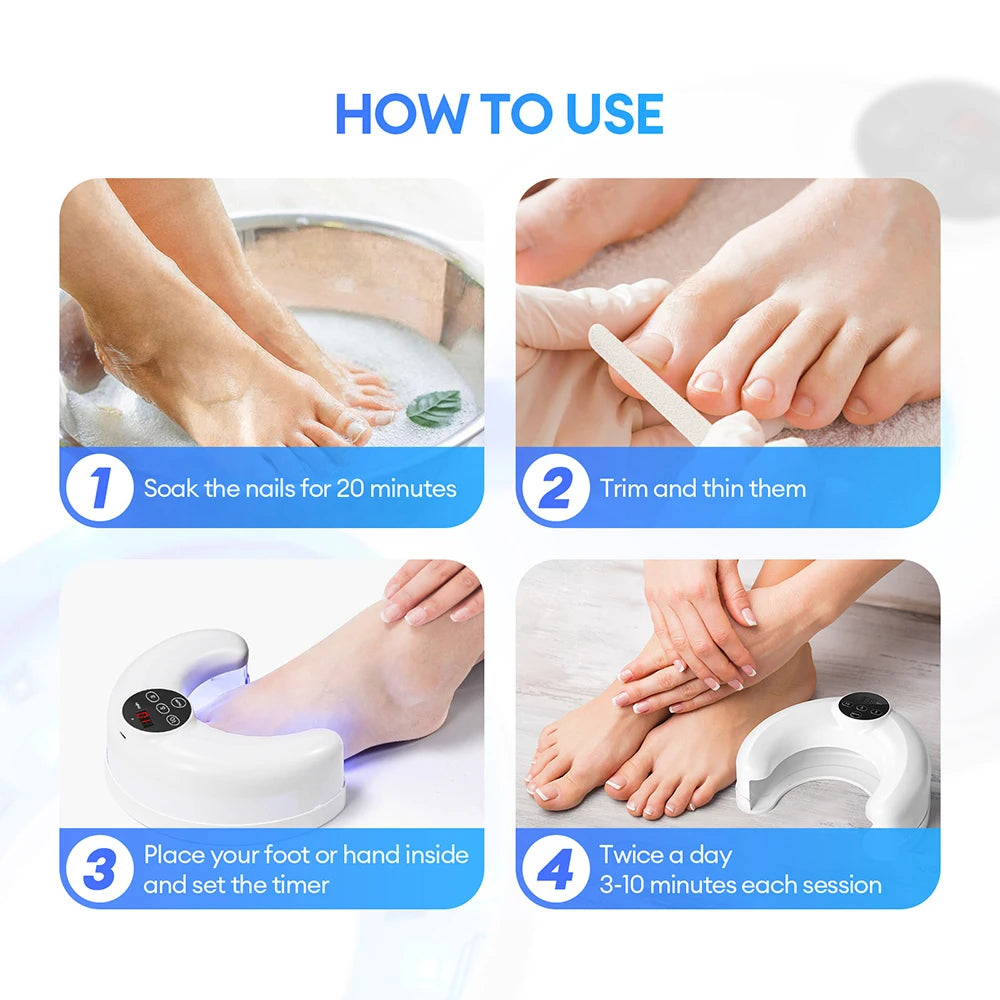 Hand Foot Nail Nail Fungus Laser Device Toenail Fungus Treatment Lamp Infrared Blue Light Anti Fungal Laser Nail Lamp